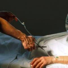 Eutanasia, gli orrori del Canada di oggi saranno “normali” domani