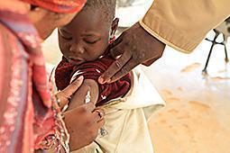 morbillo