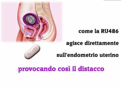 pillola-cinque-giorni-dopo